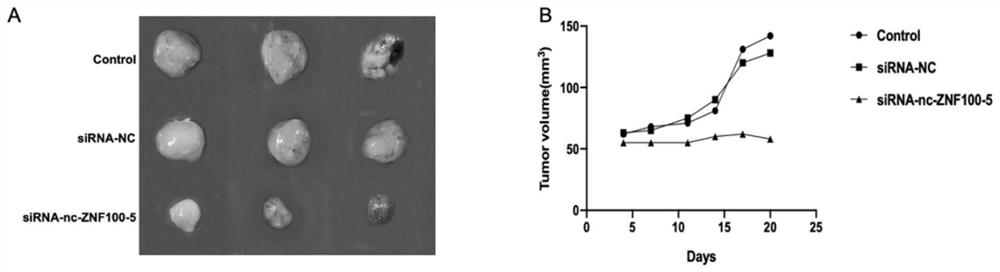 Application of lnc-znf100-5 functional expression inhibitor in preparation of medicine for treating breast cancer