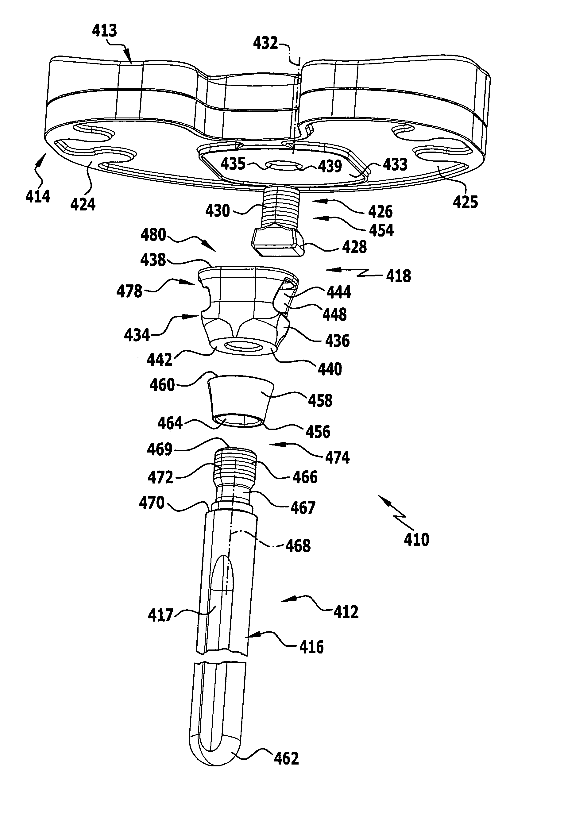 Modular implant part and knee joint prosthesis