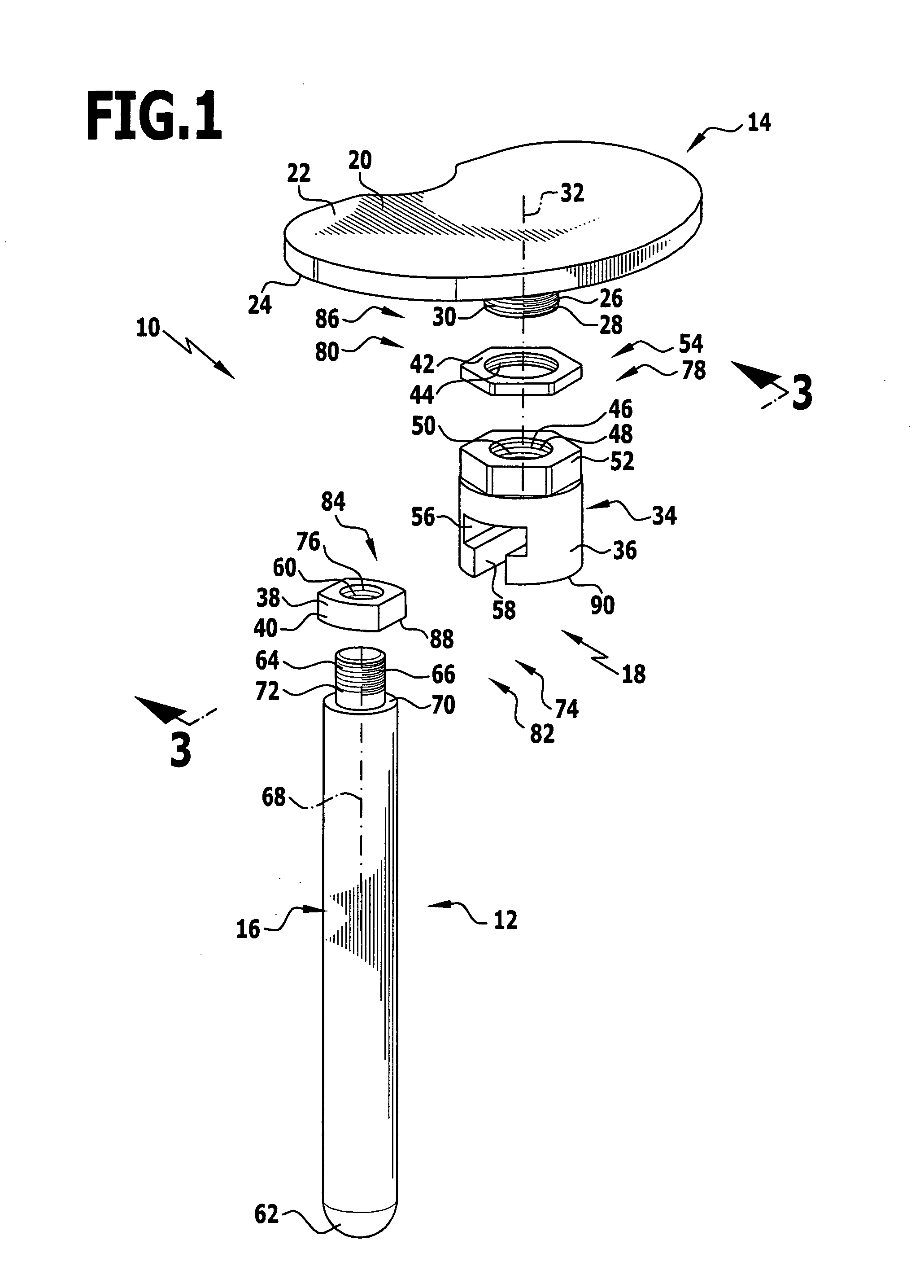 Modular implant part and knee joint prosthesis