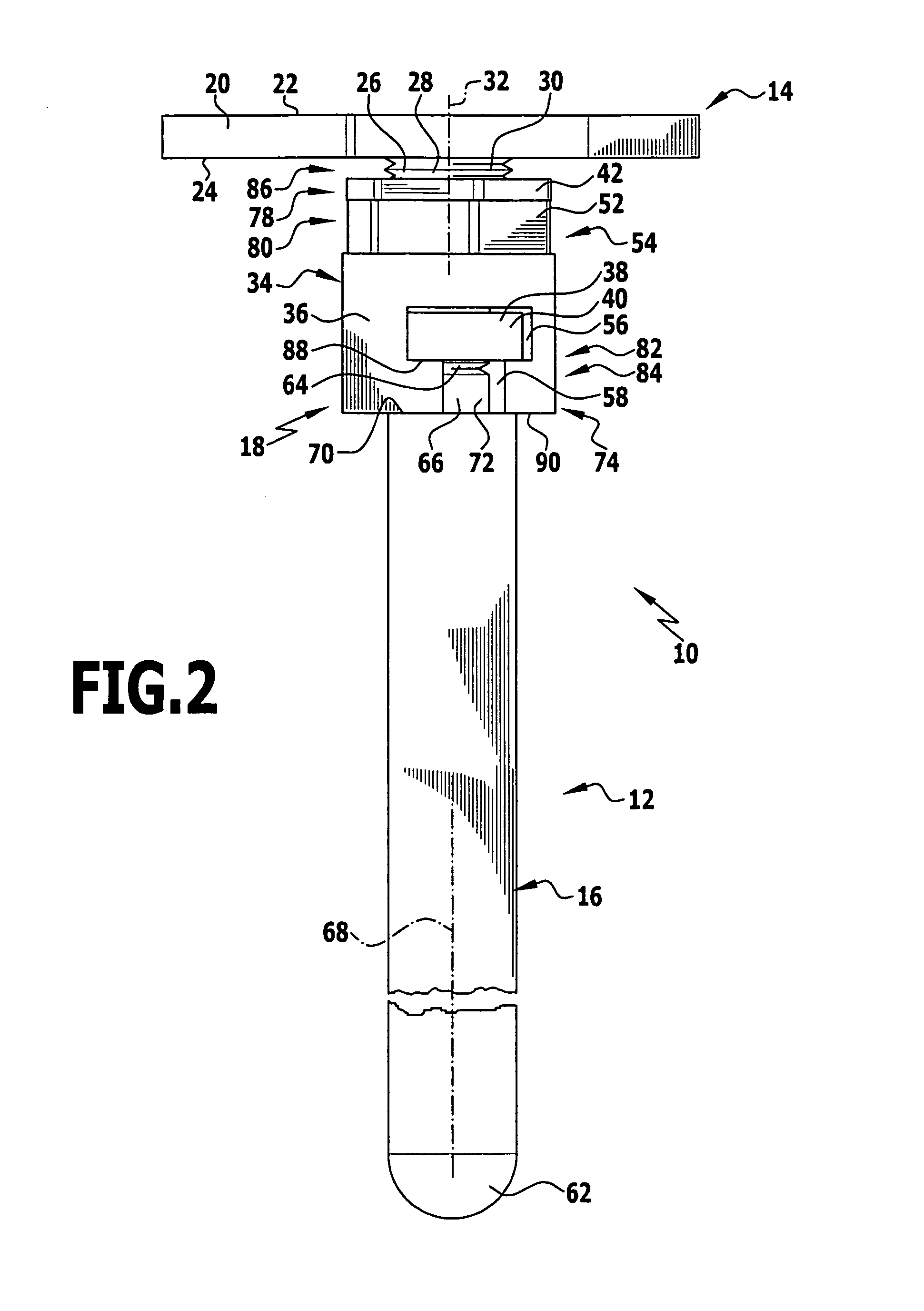 Modular implant part and knee joint prosthesis