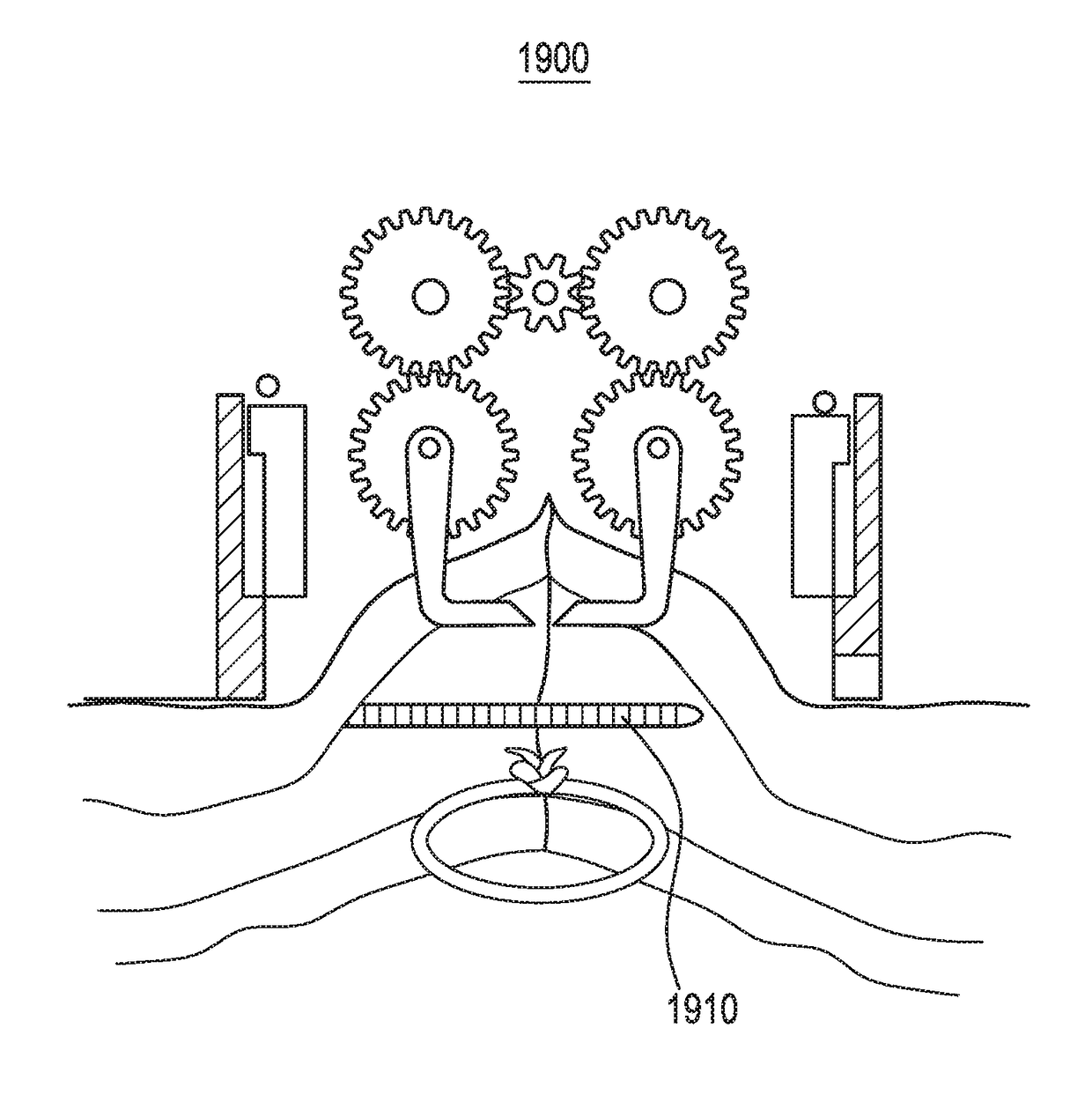 Intra Dermal Tissue Fixation Device