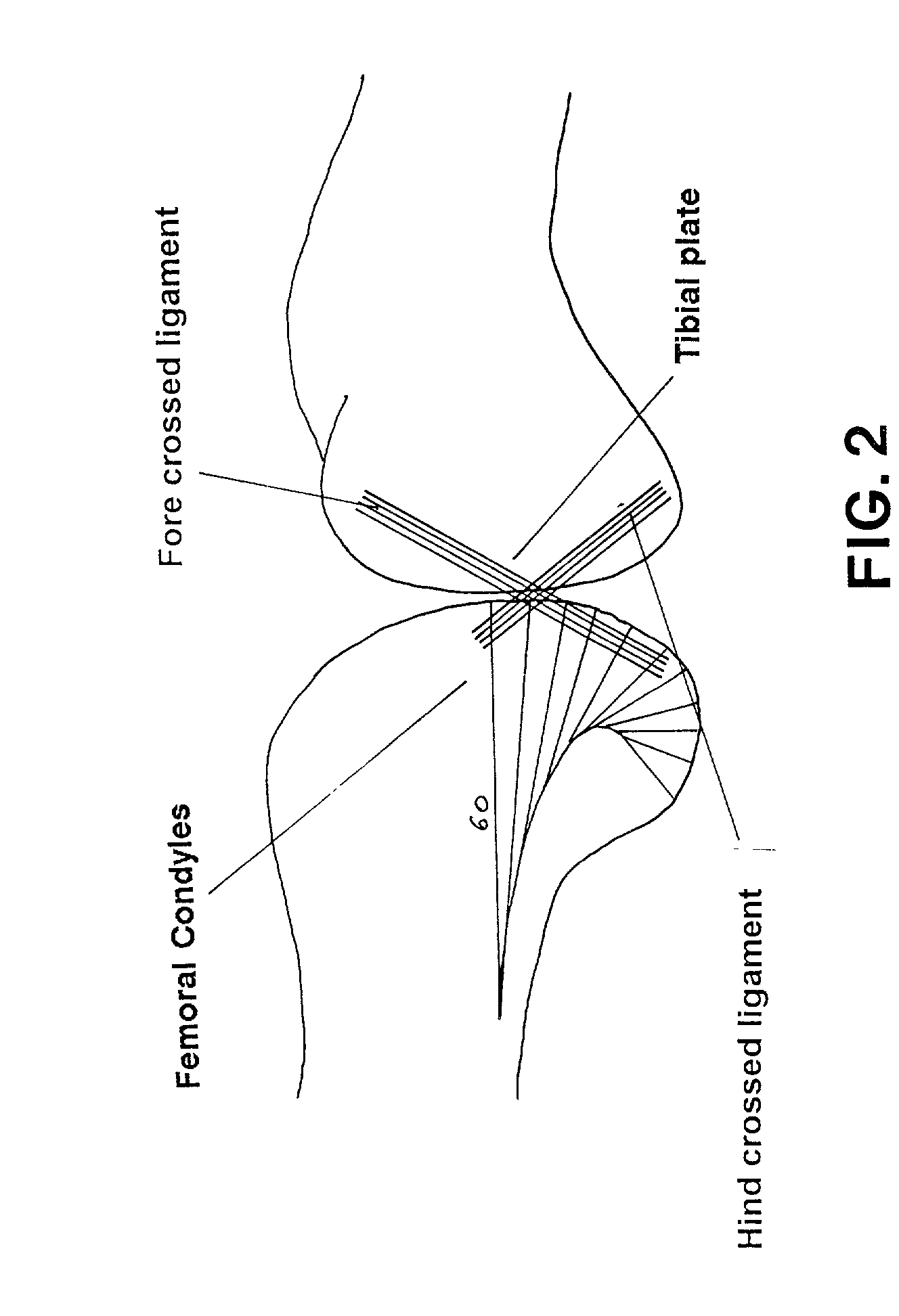 Adjustable rotation radius articulated joint for gym machines and knee tutors