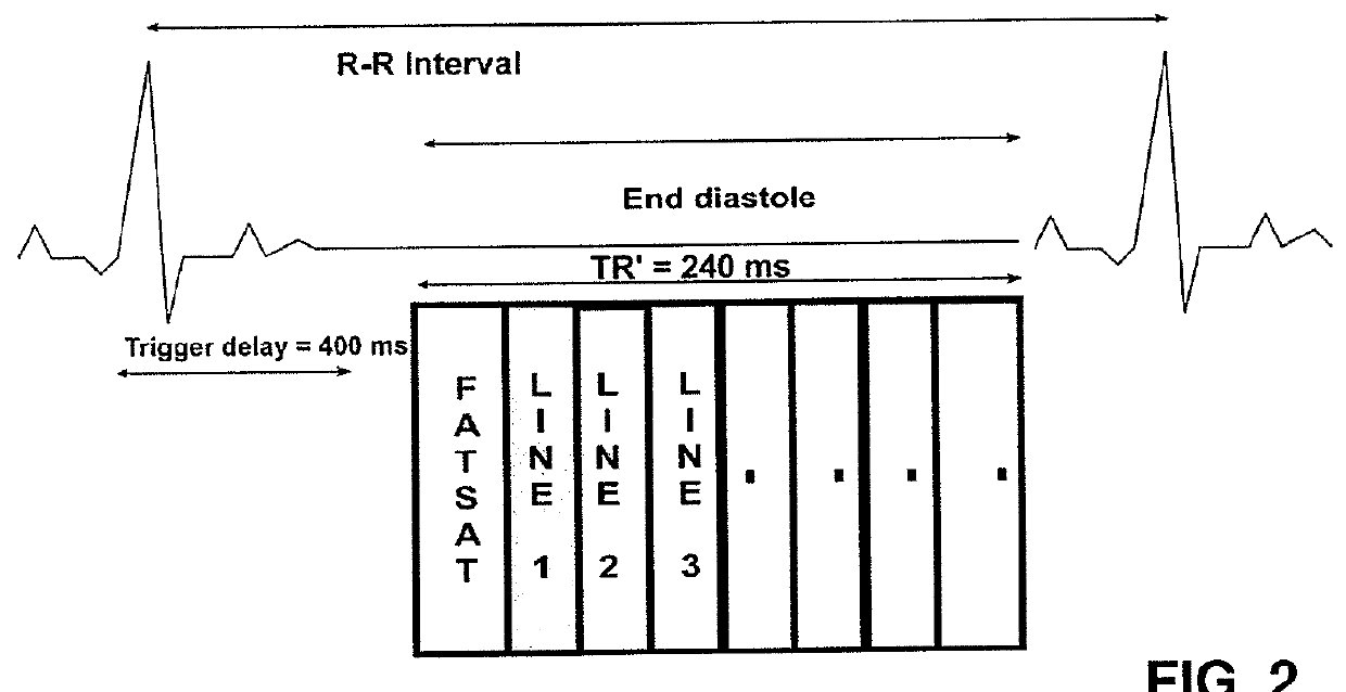 Magnetic resonance imaging method for imaging components with short transverse relaxation times (T2) in a human or an animal heart