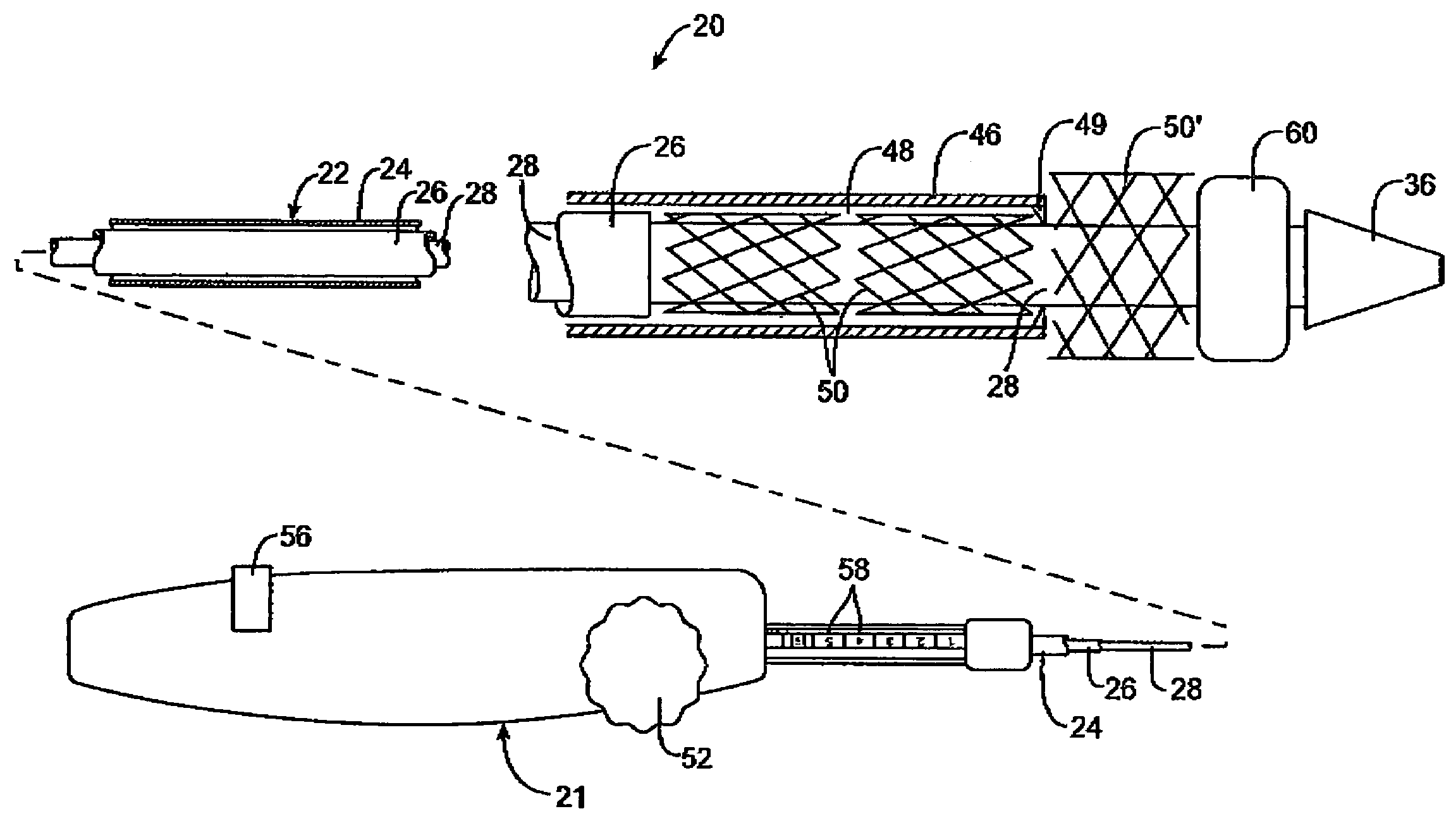 Custom-length self-expanding stent delivery systems with stent bumpers