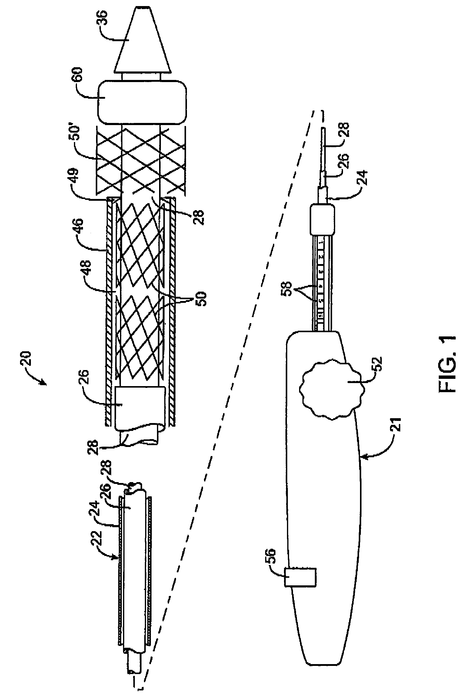 Custom-length self-expanding stent delivery systems with stent bumpers