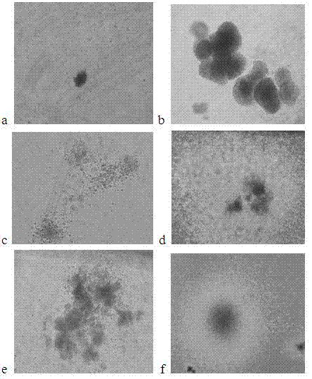 Freezing storage liquid for freezing and storing mononuclear cells