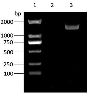 3-ketoacyl-CoA thiolase gene RkACAA1-1 and application thereof