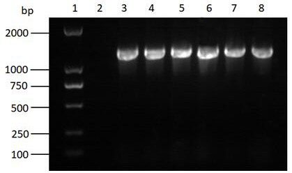 3-ketoacyl-CoA thiolase gene RkACAA1-1 and application thereof