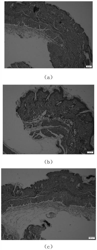 Application of alfacalcidol in preparing external preparation for intervening in skin light injury