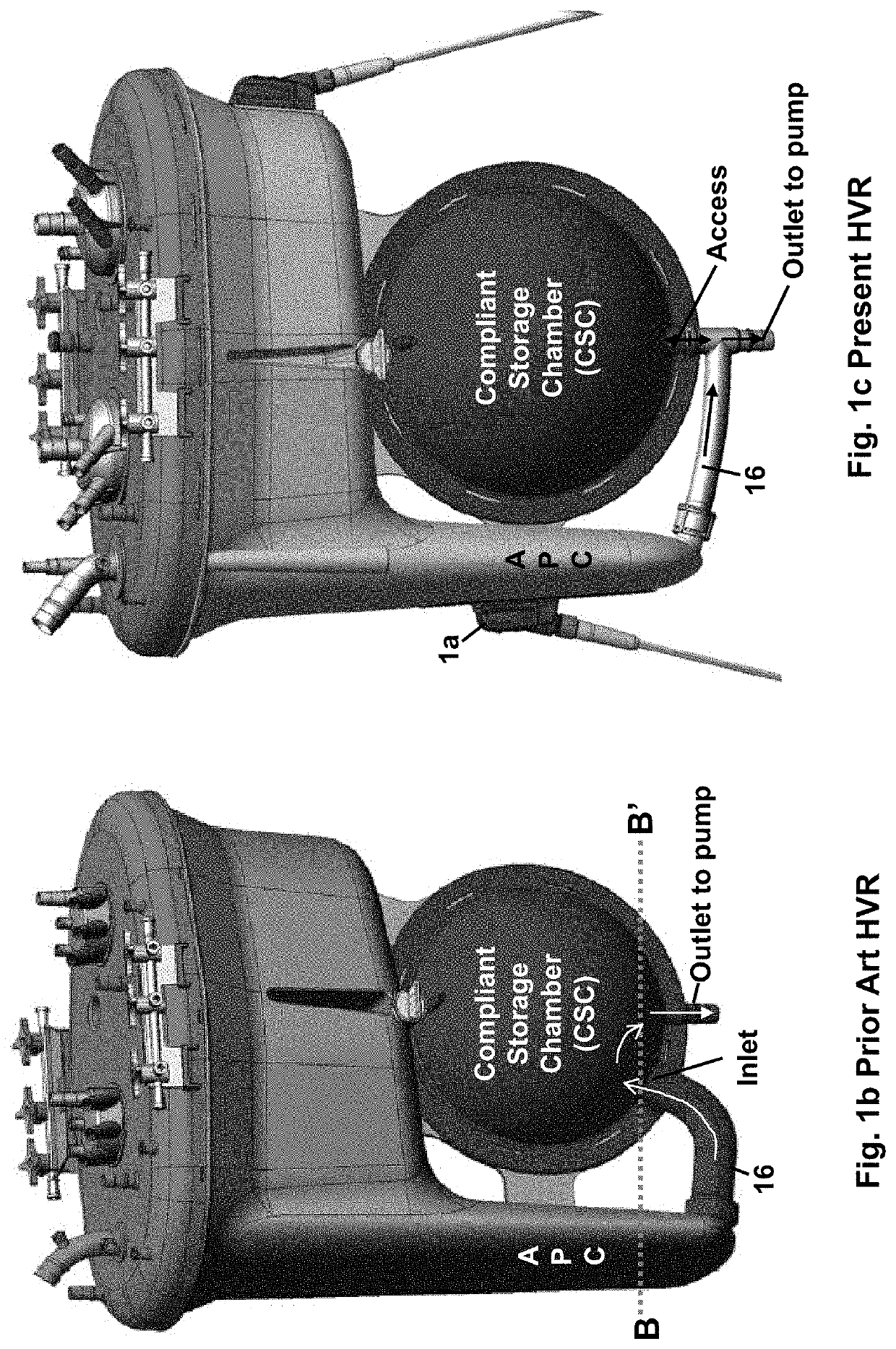 Hybrid venous reservoir