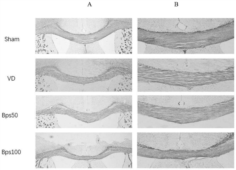 Application of beraprost sodium as medicine for improving vascular dementia