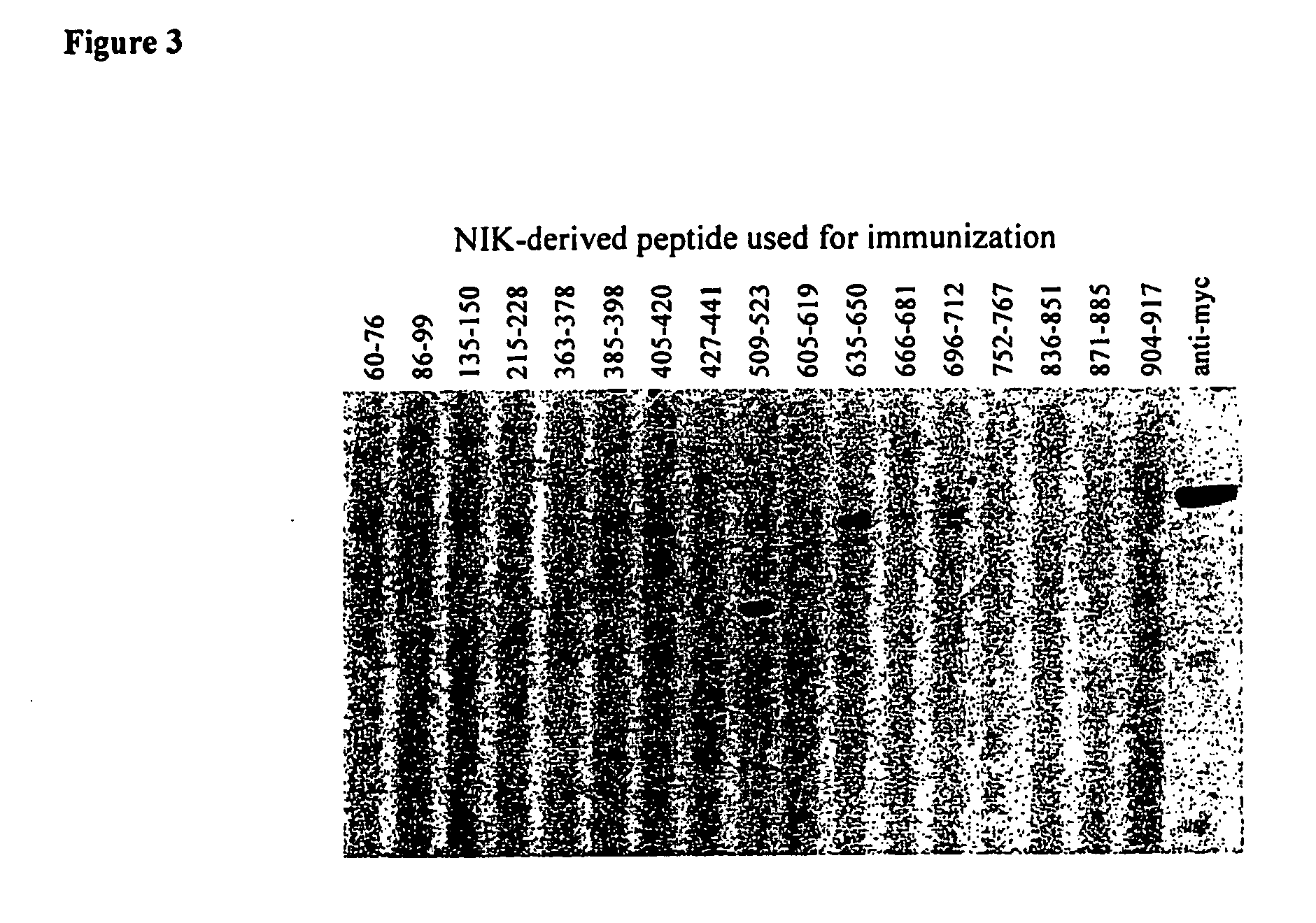 Anti-nik antibodies and uses thereof