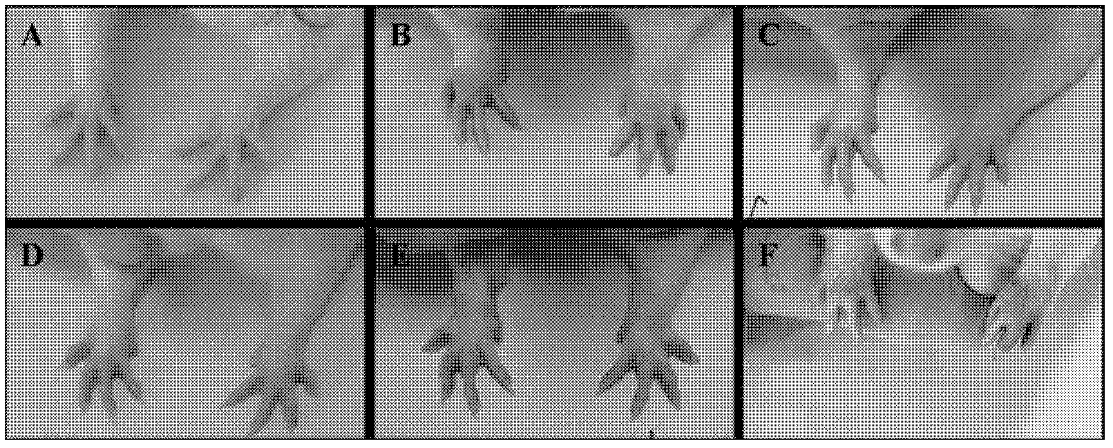 Extracts of total saponins of pterocephalus hookeri and preparation method and application thereof