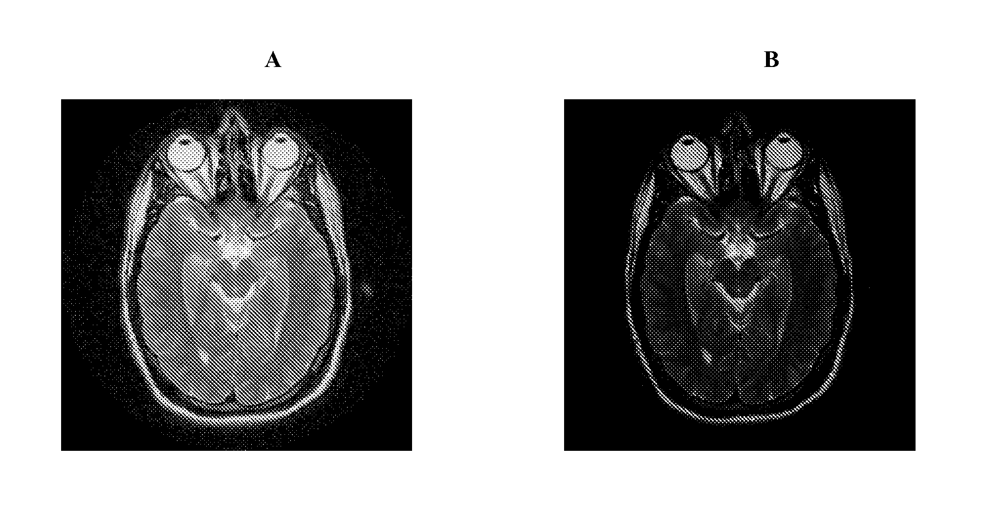 Interferometric Magnetic Resonance Imaging System and Related Method