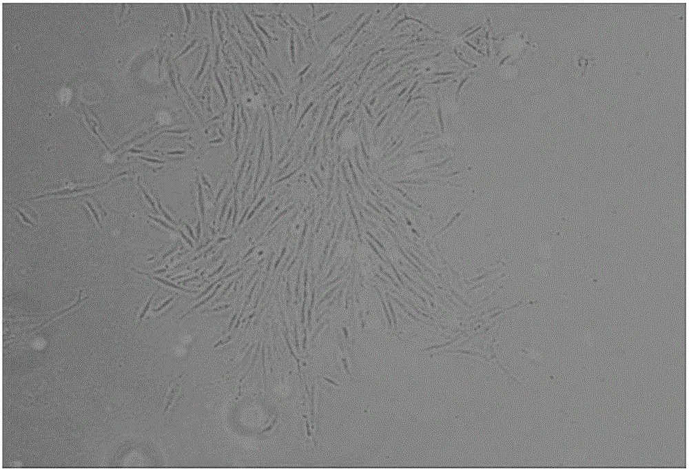 Separation method and application of placenta-derived stem cells