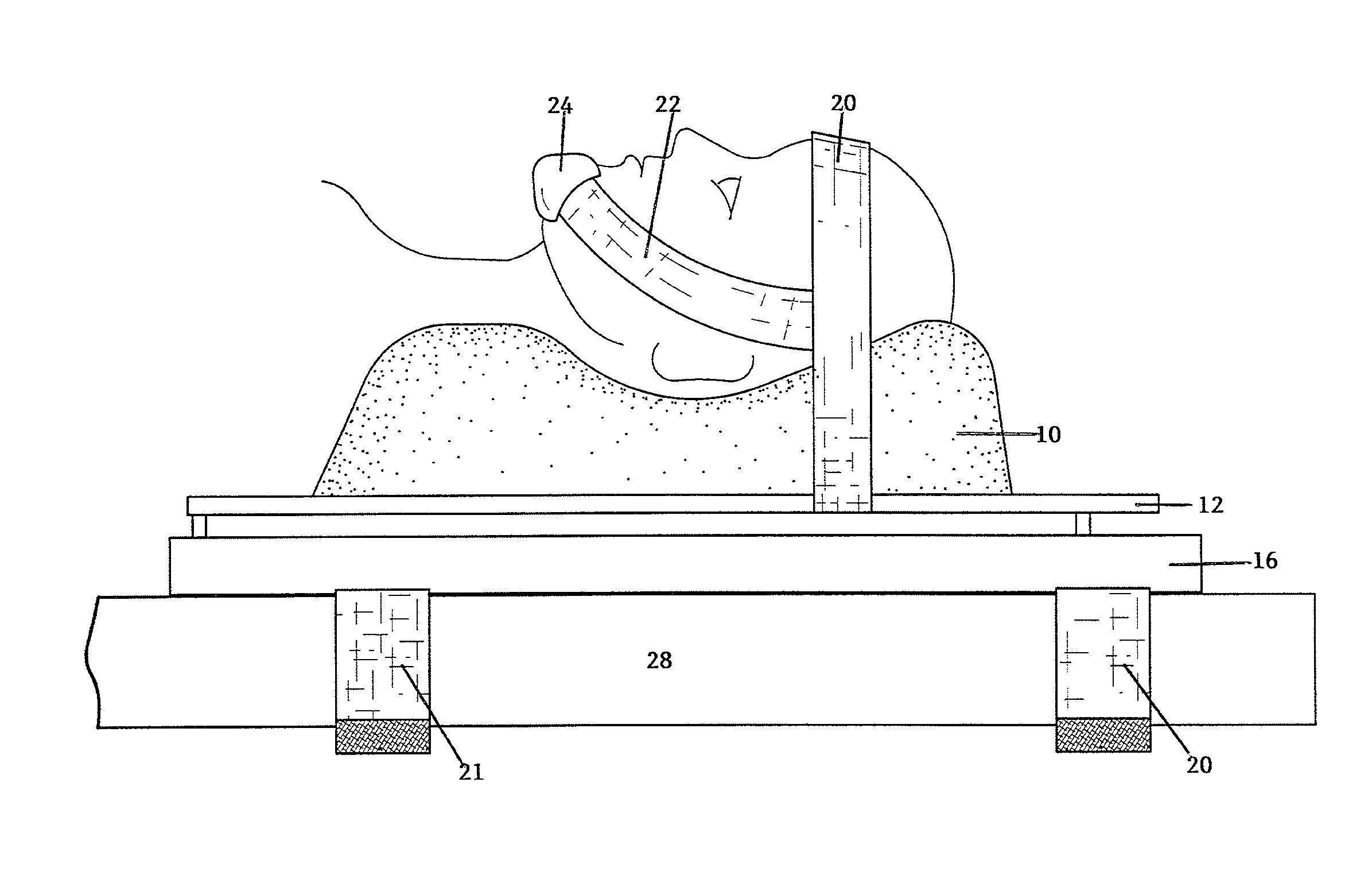 C-spine head stabilization device