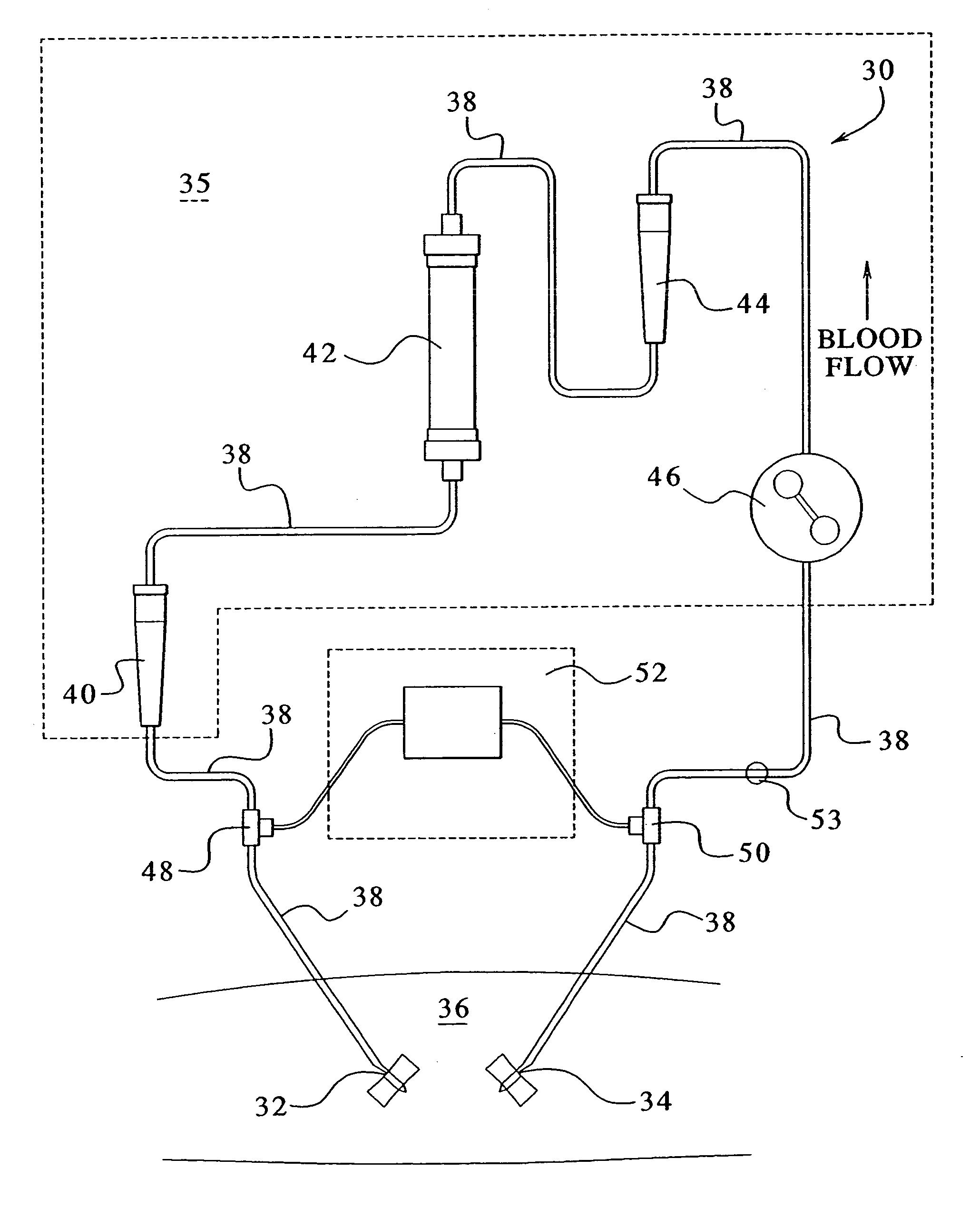 Access disconnection systems and methods