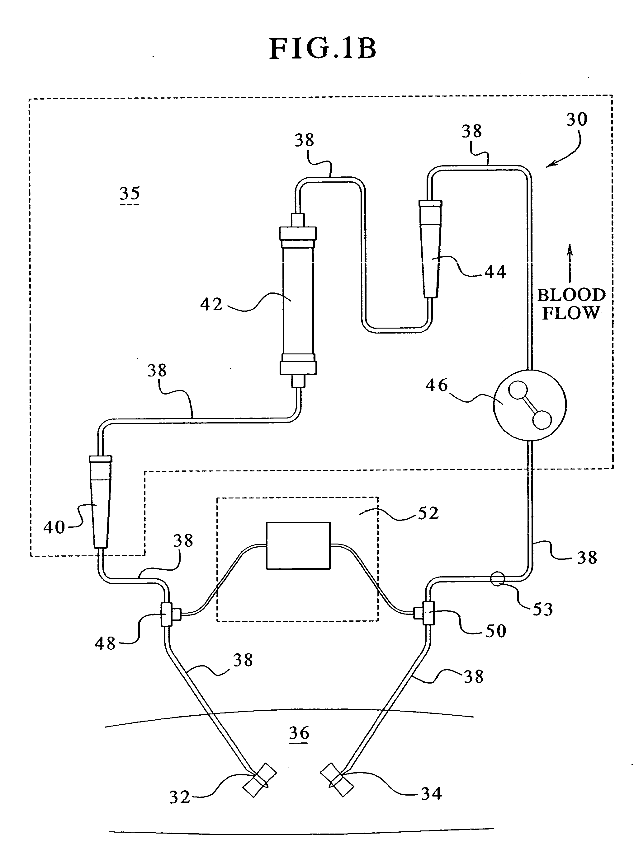 Access disconnection systems and methods