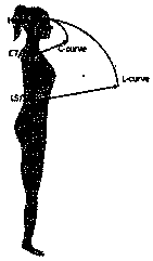 Wearable intelligent monitoring device and method for monitoring movement, spinal curvature and joint wear