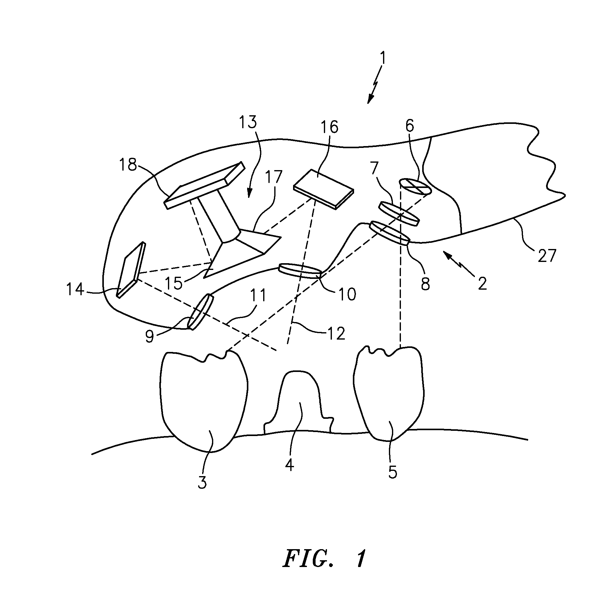 Device for determining the 3D coordinates of an object, in particular of a tooth