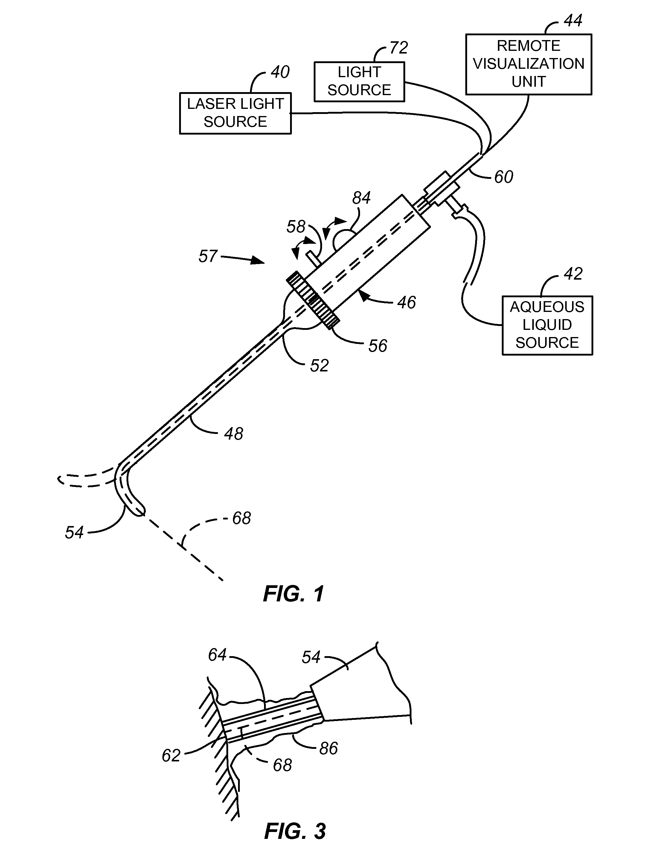 Laparoscopic Laser Device and Method