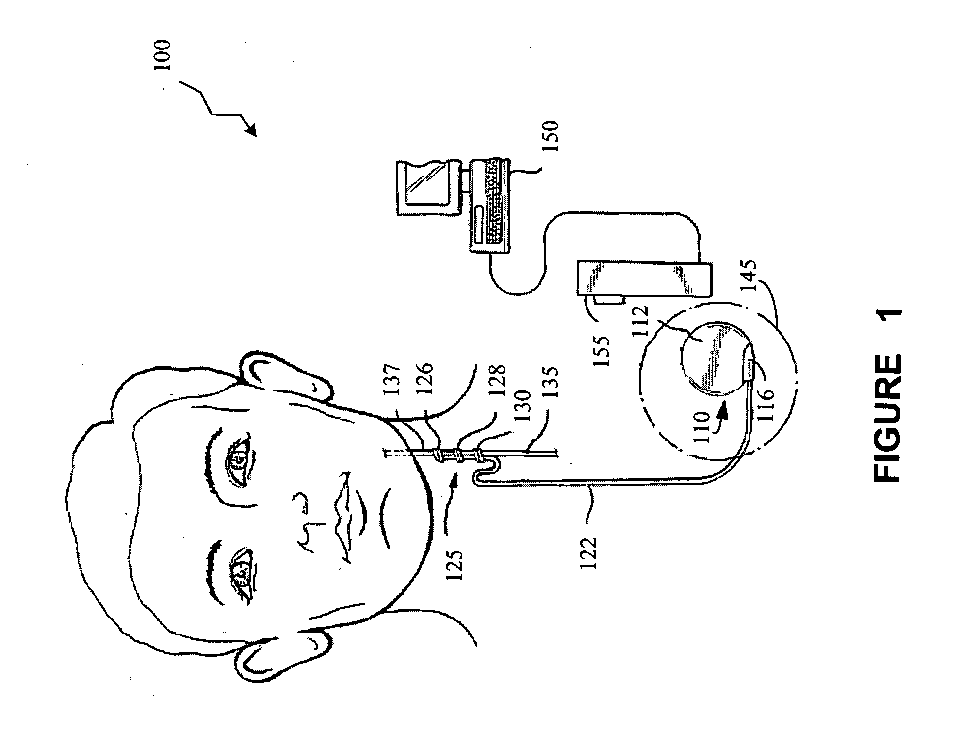 Patient management system for providing parameter data for an implantable medical device