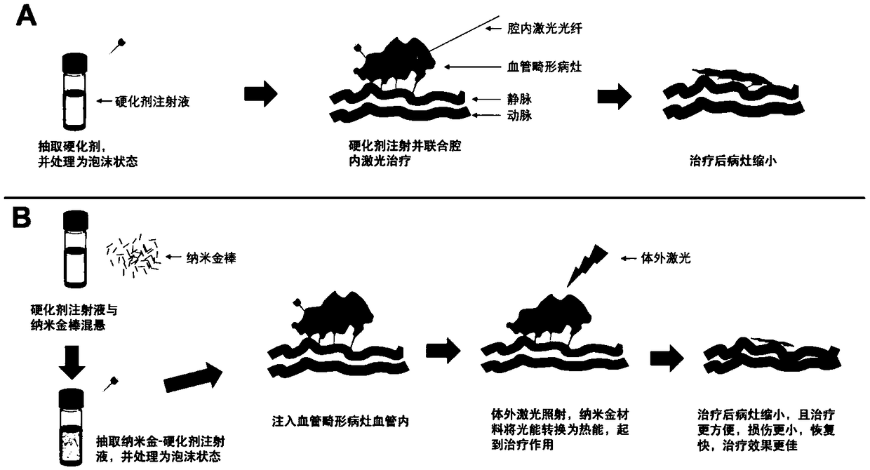 Nanogold-rod-containing hardener for treating vascular malformation, and preparation method