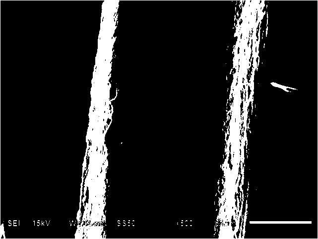 Preparation method of multifunctional intravascular stent