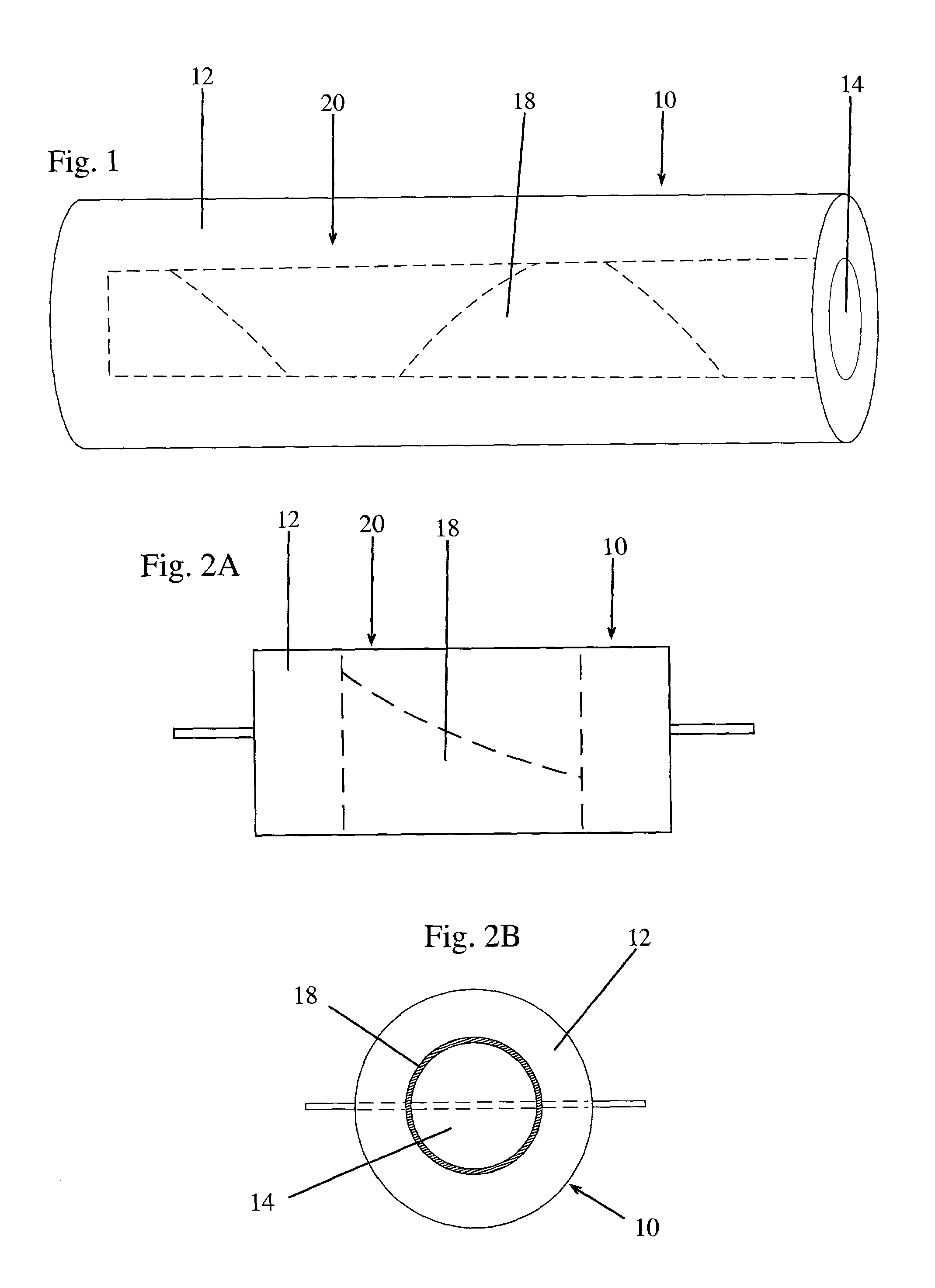 Coaxially combined meat roast with steaks or chops cut from same