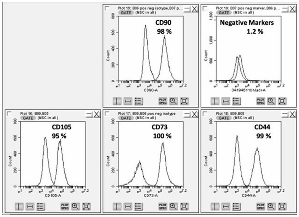 Exosome preparation prepared from umbilical cord mesenchymal stem cells, and preparation method of exosome preparation