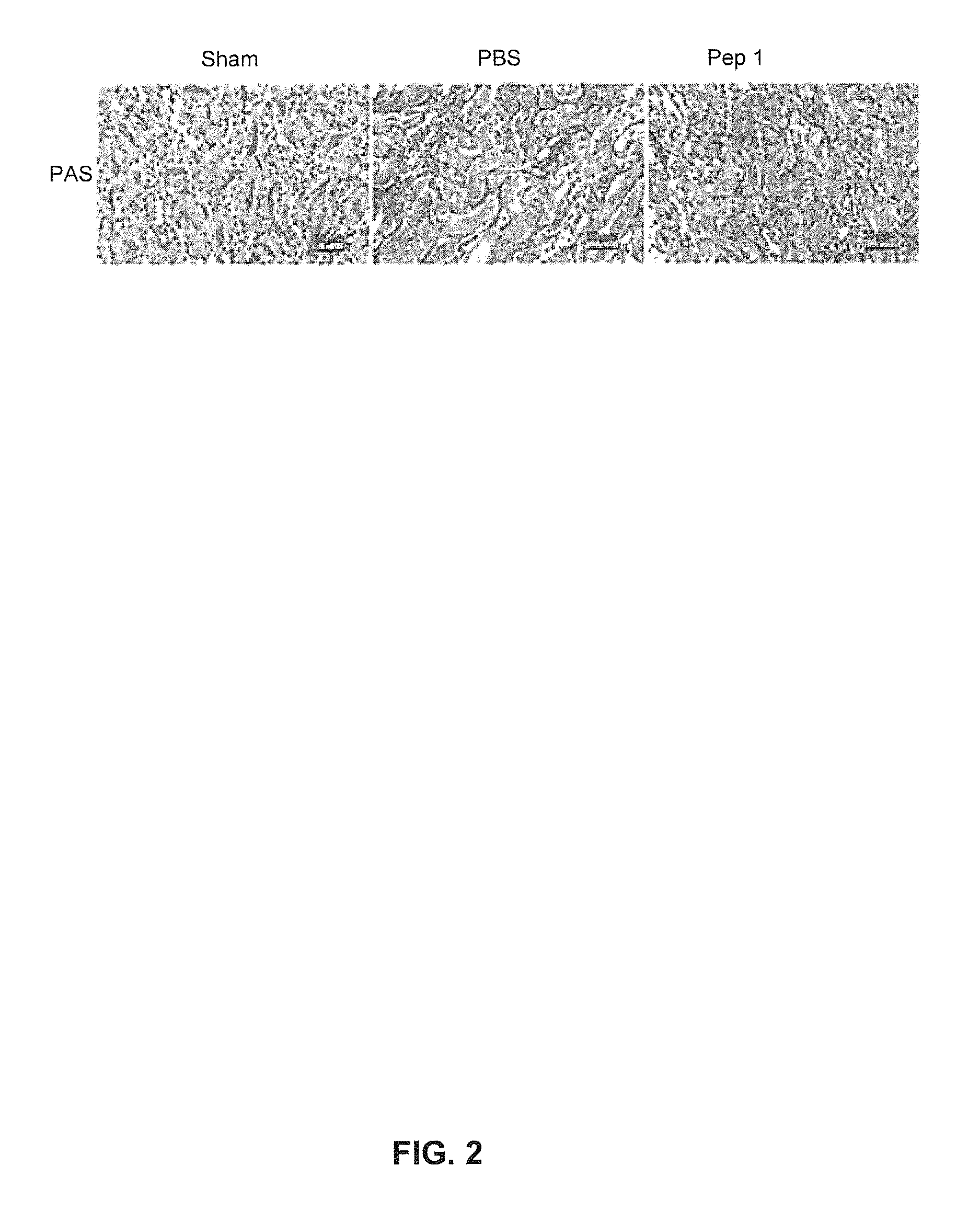 Composition for Organ, Tissue, or Cell Transplantation, Kit, and Transplantation Method