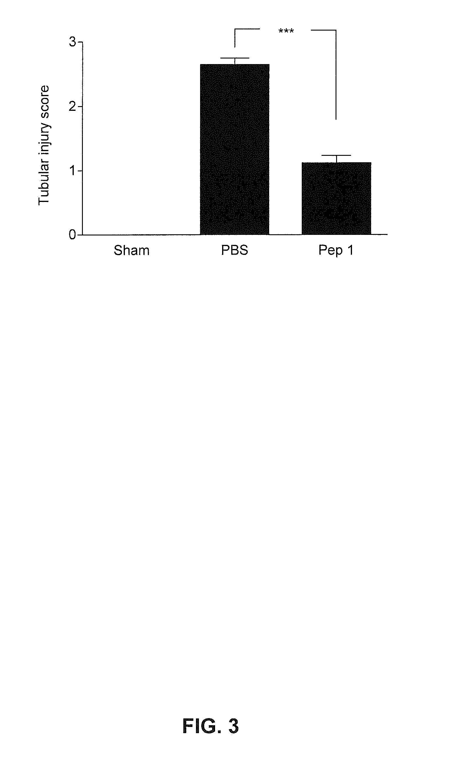 Composition for Organ, Tissue, or Cell Transplantation, Kit, and Transplantation Method