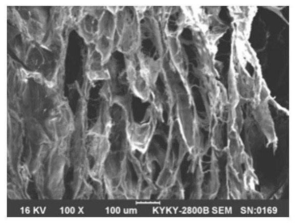 A composite collagen dressing for repairing difficult-to-heal wounds and its preparation method