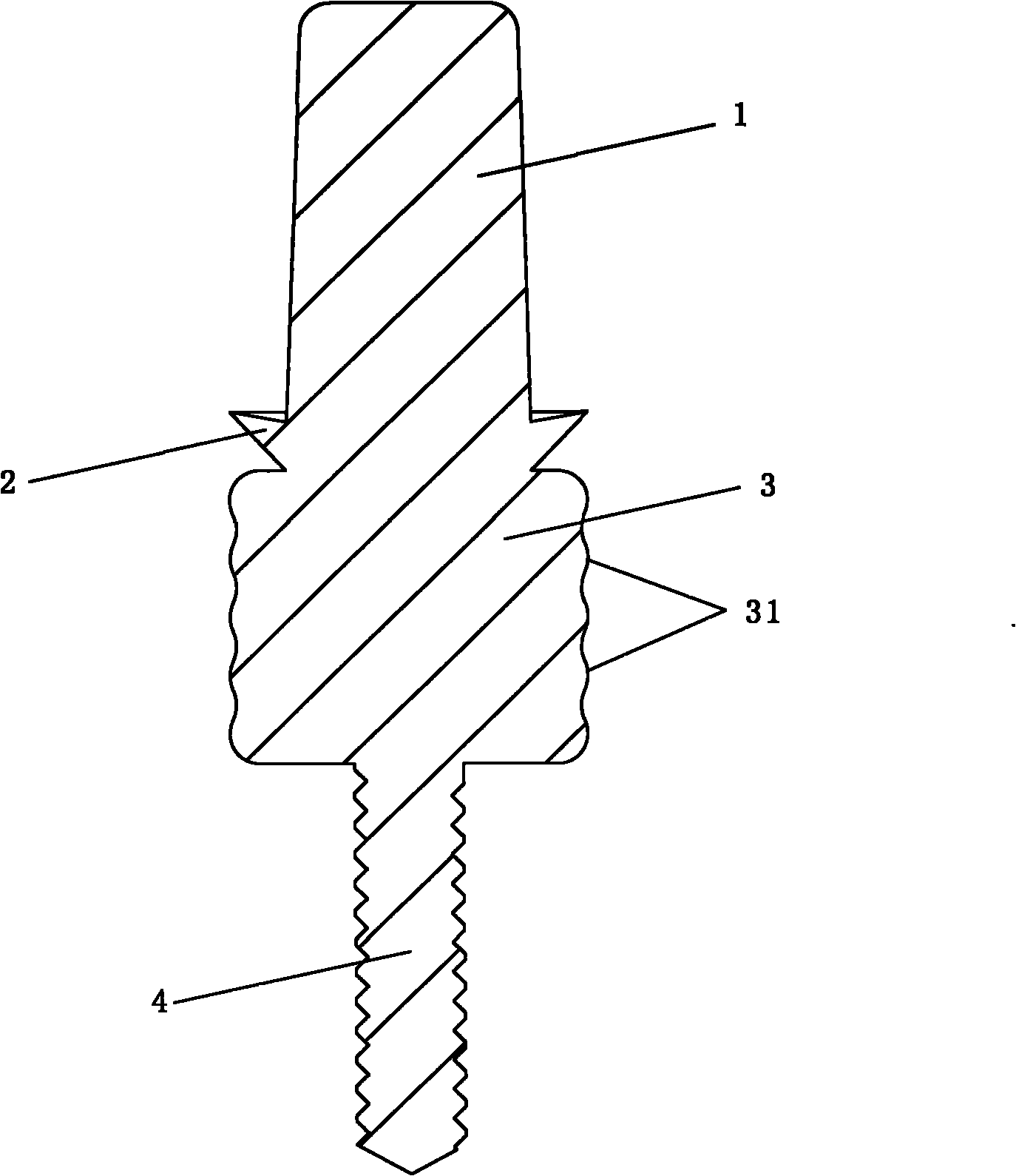 Single-tooth residual root implant