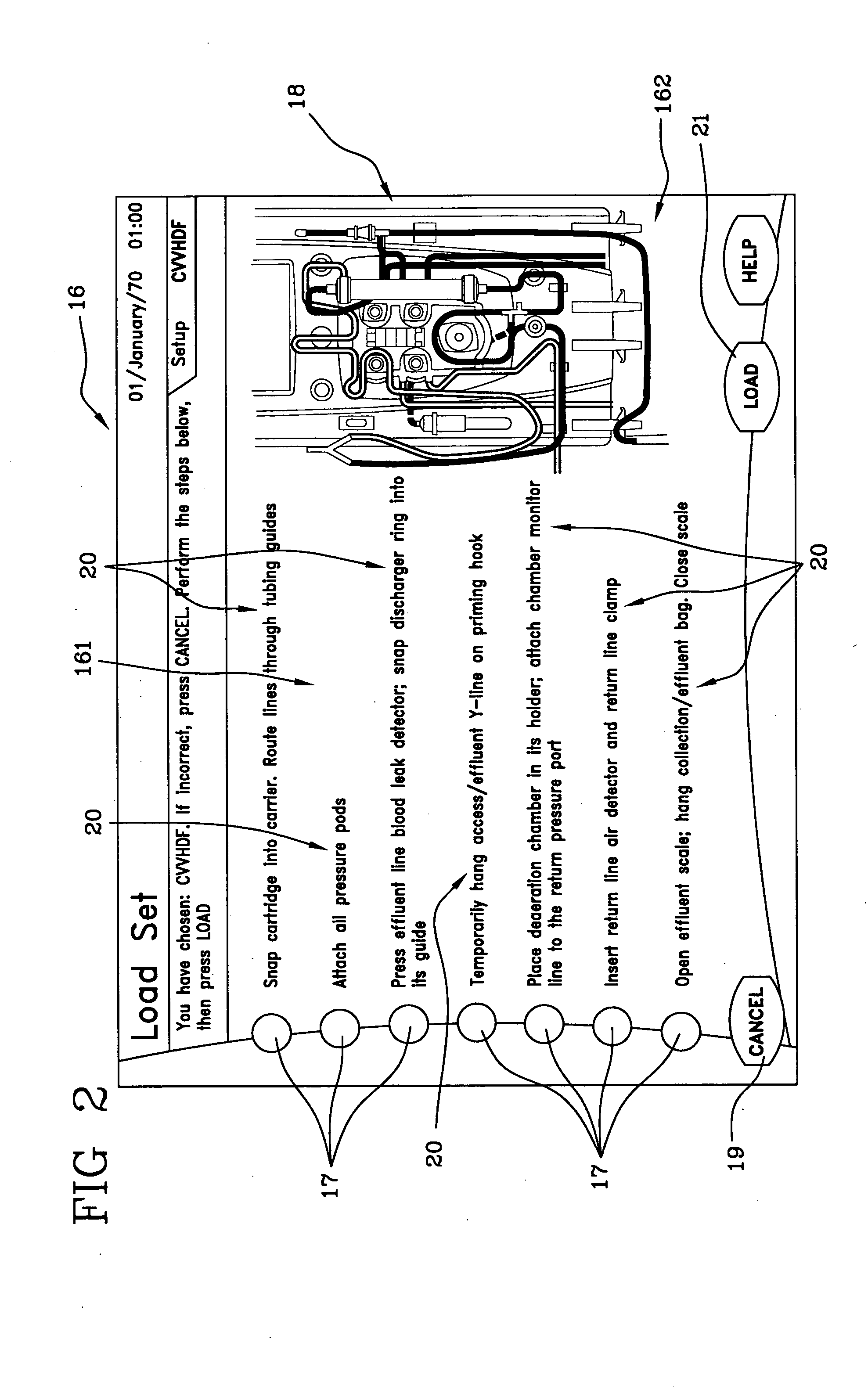 User interface for an extracorporeal blood treatment machine