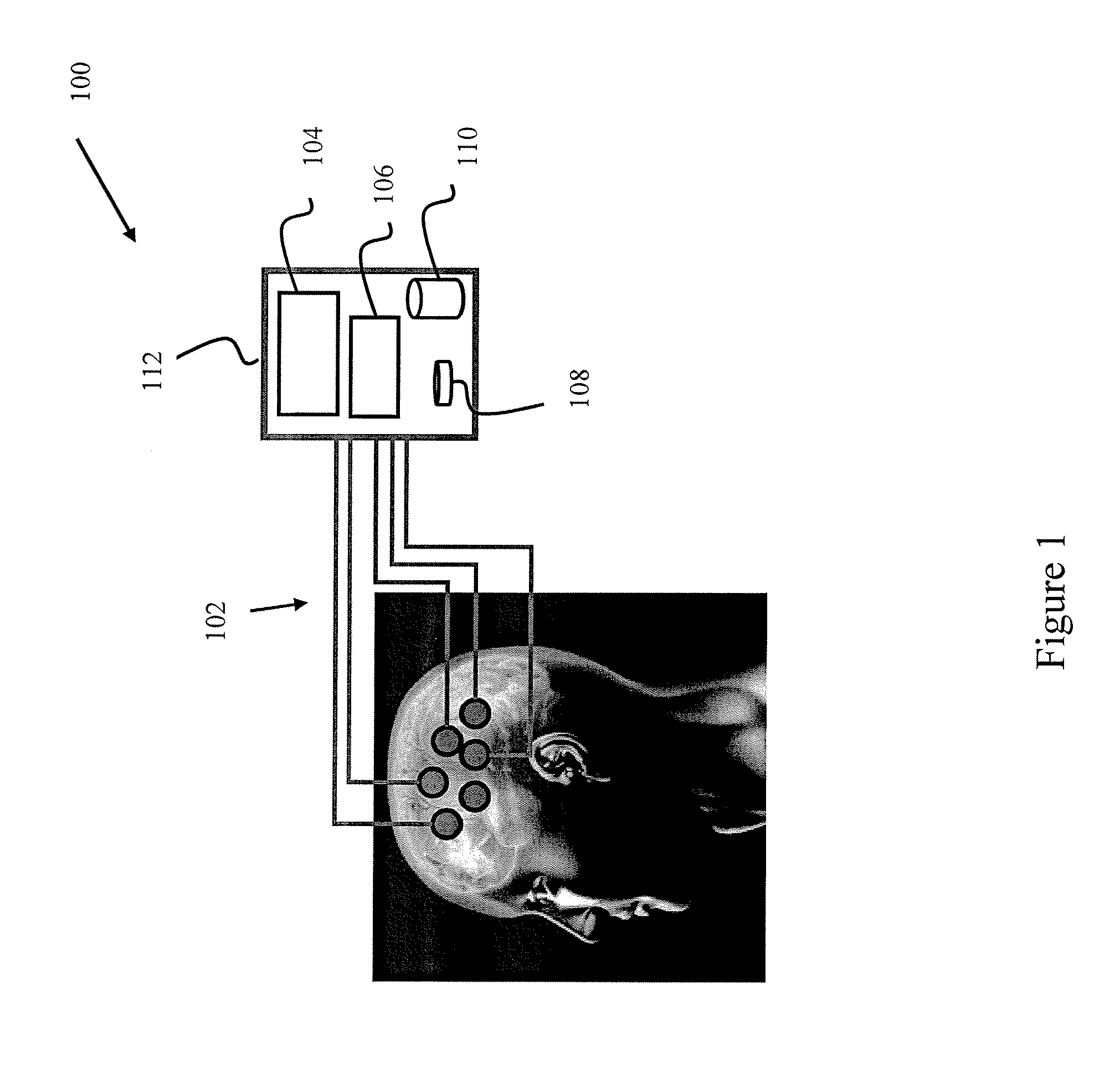 Seizure detection device and systems