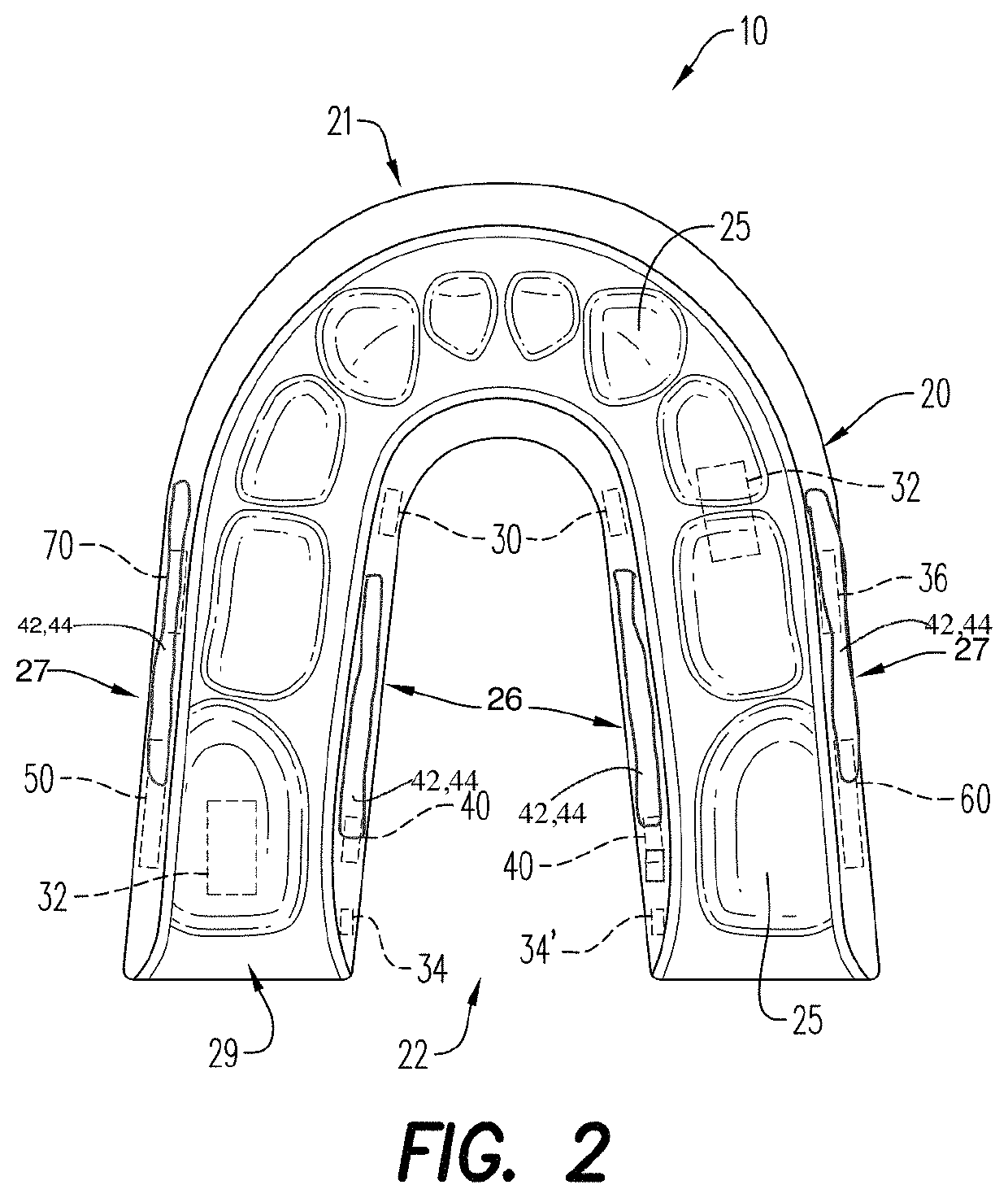 Removable mandibular pharmaceutical delivery device