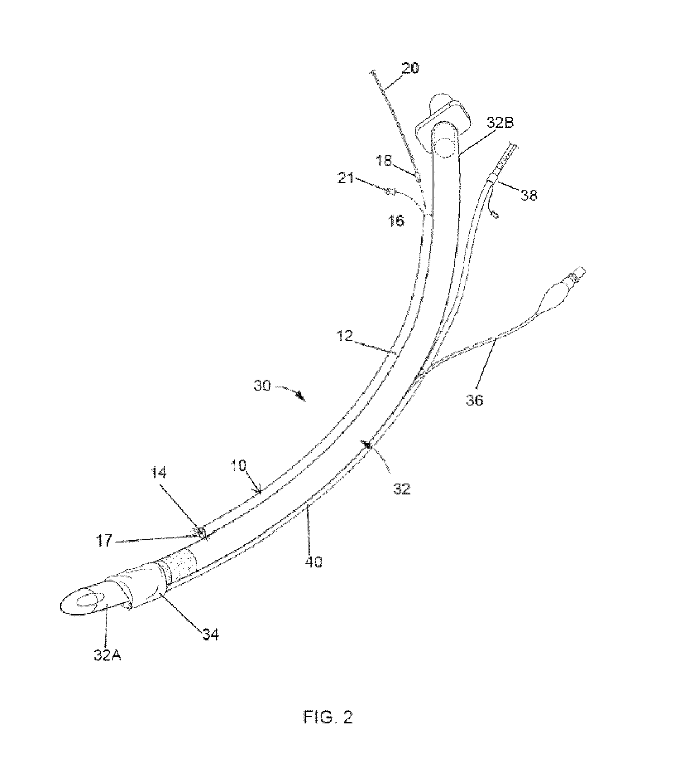 Medical devices and methods of placement