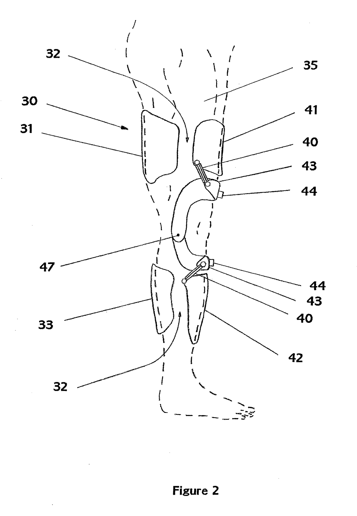 Exoskeleton Chassis