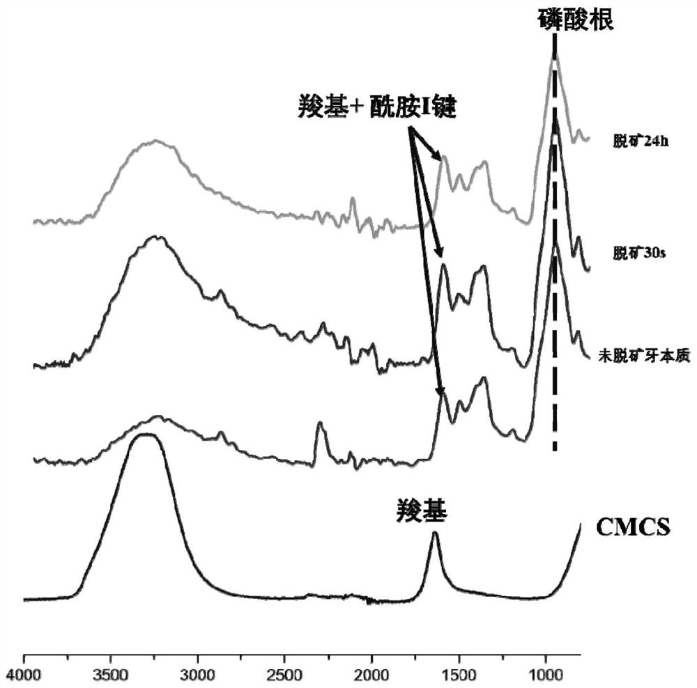 Application of carboxymethyl chitosan in preparation of dentin collagen fiber demineralization material