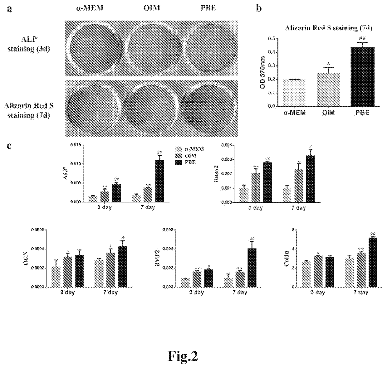 Fetal tissue extract, methods for producing the extract, and the use thereof