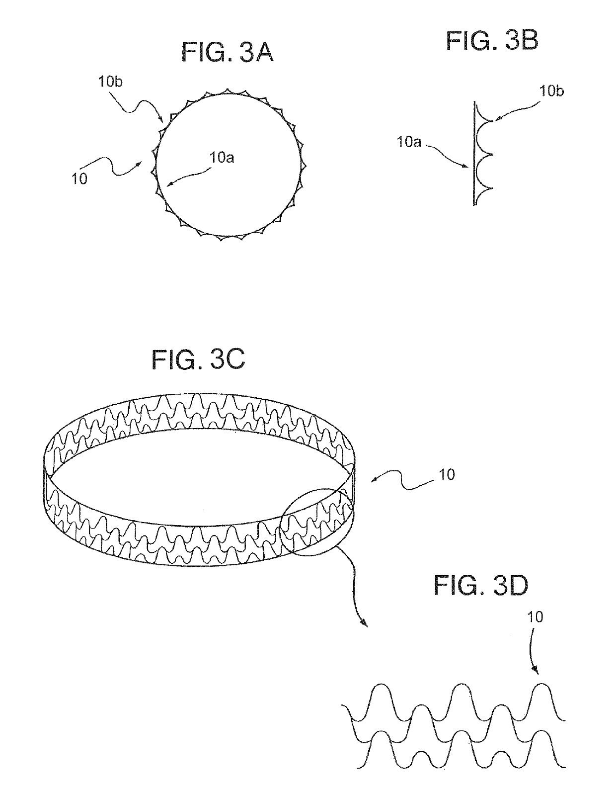 Endovascular implant