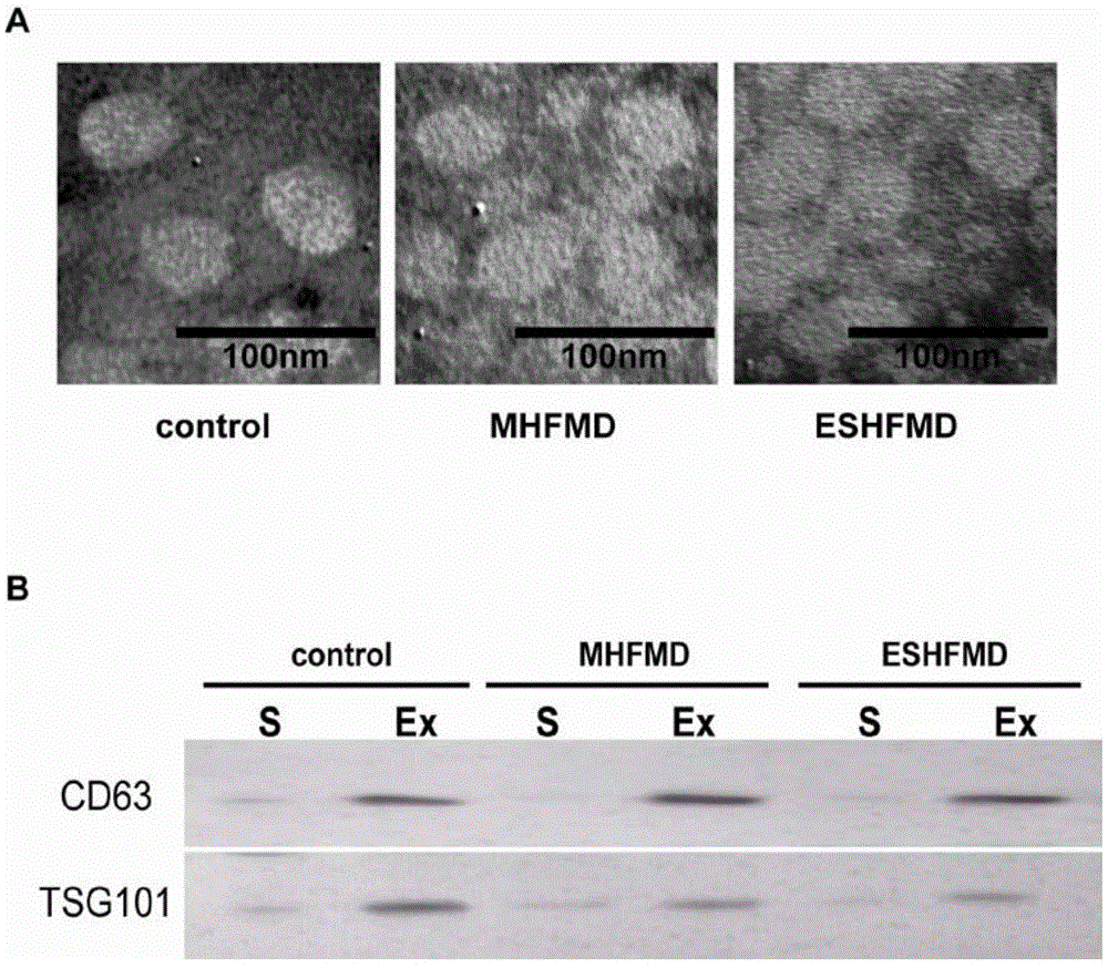 Molecular marker for diagnosing extremely severe hand, foot and mouth disease, its detection method and kit