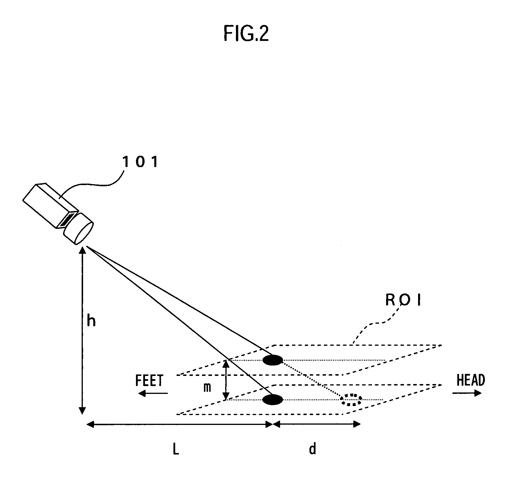 Respiration Monitoring Apparatus, Respiration Monitoring System, Medical Processing System, Respiration Monitoring Method, And Respiration Monitoring Program