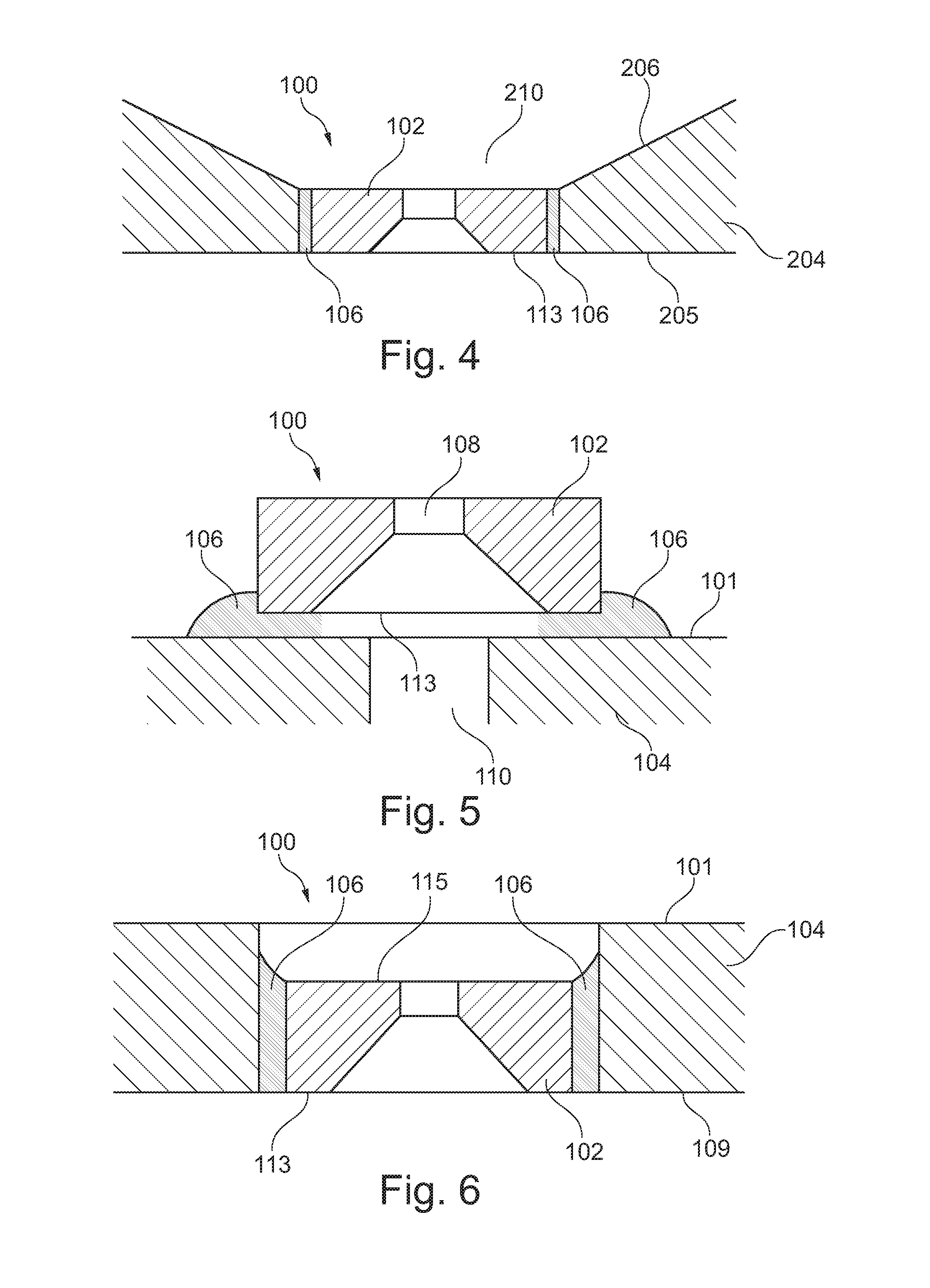 Chip assembly for use in a microfluidic analysis system