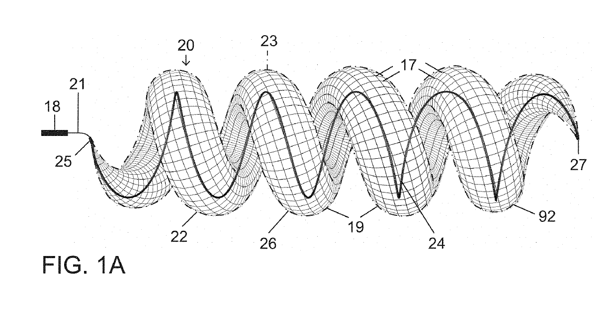 Micro-Macro Endovascular Occlusion Device and Methodology