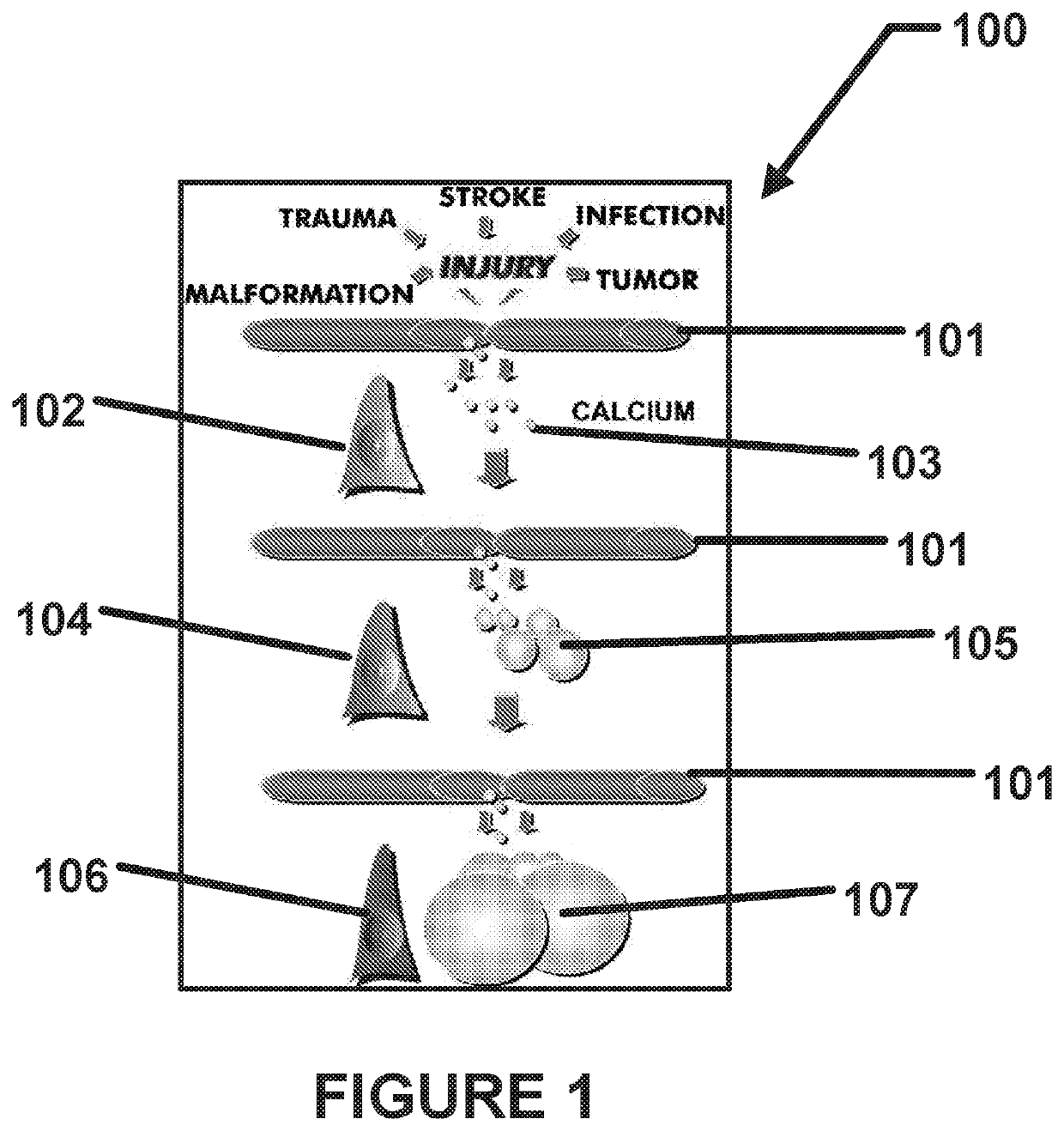 Method using enteric-coated etidronate for treating calcification, hypercalcaemia, and calcinosis of the brain and other organs