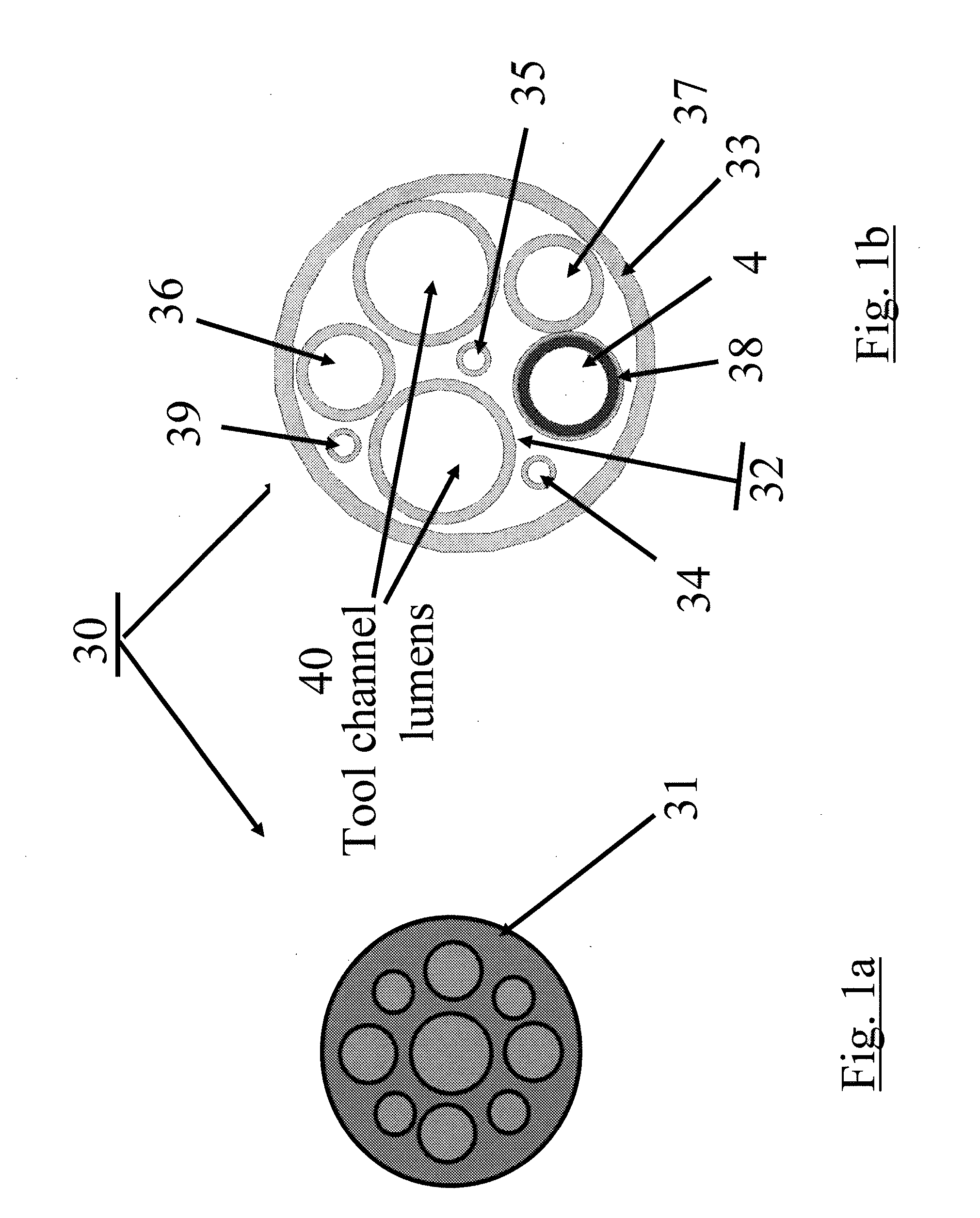 Substantially rigid and stable endoluminal surgical suite for treating a gastrointestinal lesion