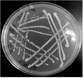 A kind of microbe-enhanced bacterial agent and its application that can significantly promote the composting effect before domestic waste incineration