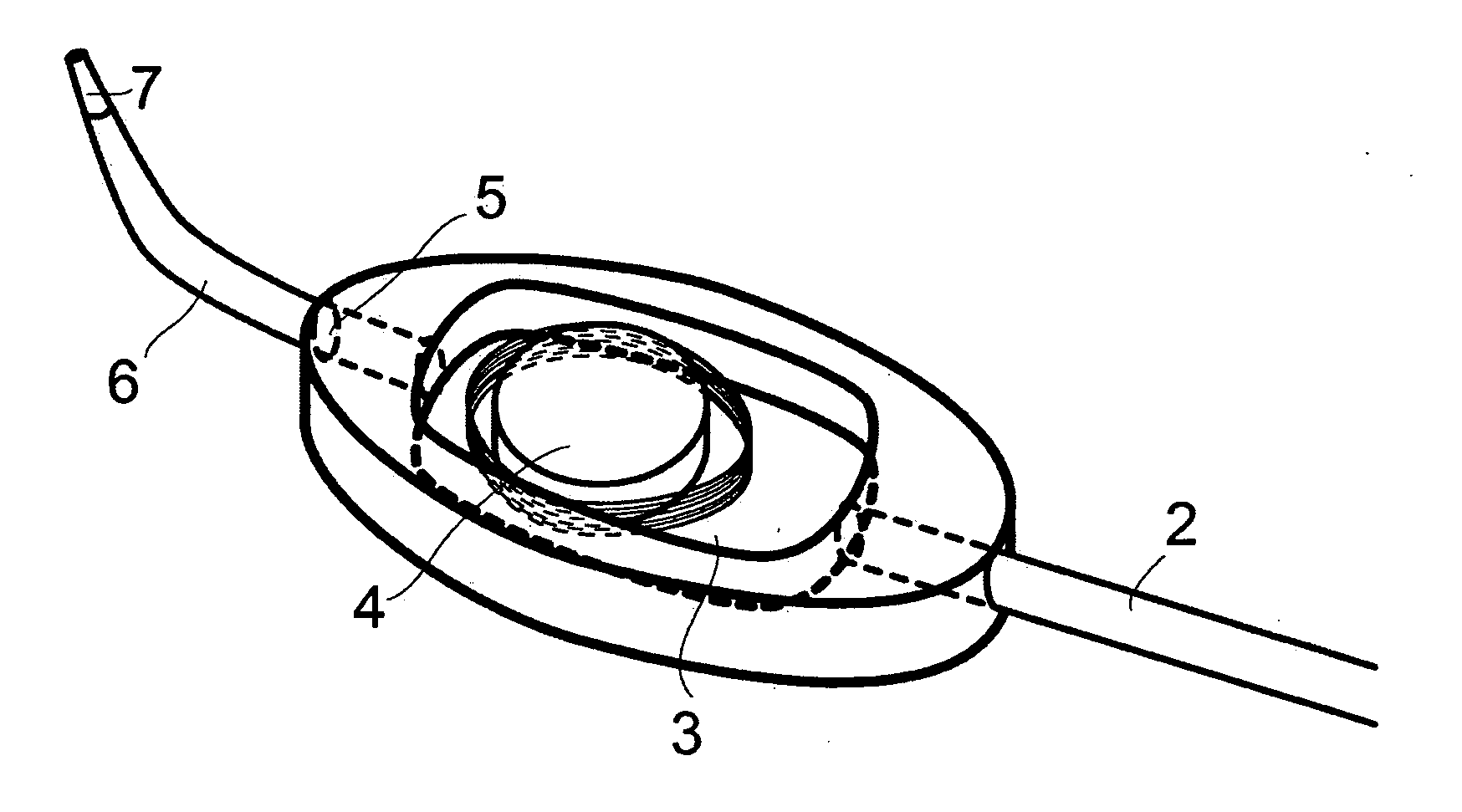 Toothcleaning Device